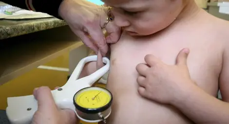 57% от децата в САЩ ще страдат от затлъстяване до навършване на 35 г.