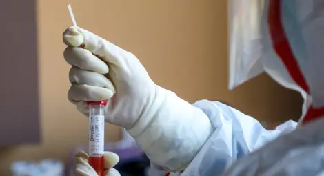 Правят втора проба за Ковид-19 на хванатия мигрант от Афганистан с температура Правят втора проба за Ковид-19 на хванатия мигрант от Афганистан с температура