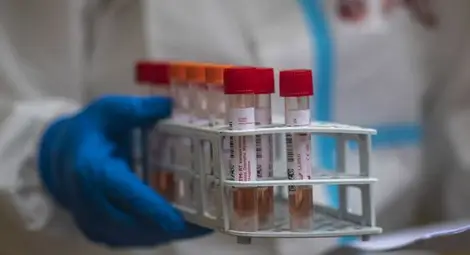 203 са жертвите на вируса от последното денонощие, 9679 души са в болница 203 са жертвите на вируса от последното денонощие, 9679 души са в болница