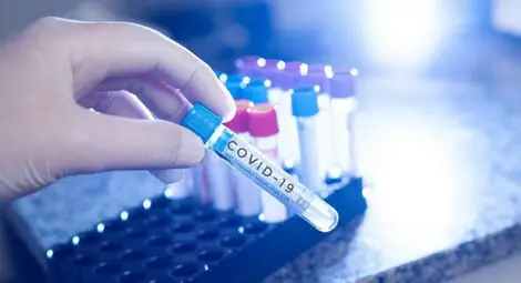 Русе за пръв път мина границата от 500 оздравели от К-19 за денонощие