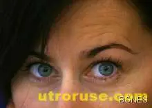 Нови лещи възстановяват зрението