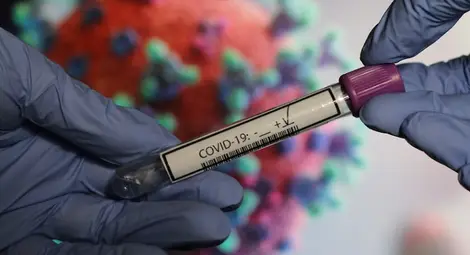 1716 са новозаразените у нас