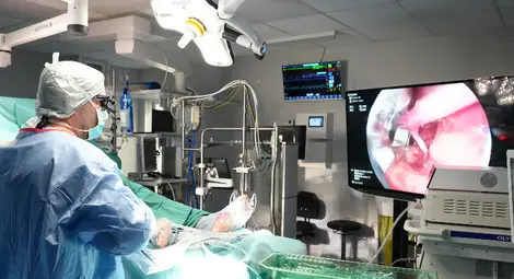 С минимален разрез кардиохирурзите на МЕДИКА безопасно вземат вена за коронарен байпас