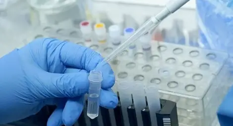 Цената, за която никой не говори. Колко всъщност струва PCR-тестът?