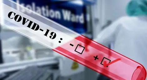 4054 са новите заразени с COVID-19, 30% от тестваните, 54 са починали