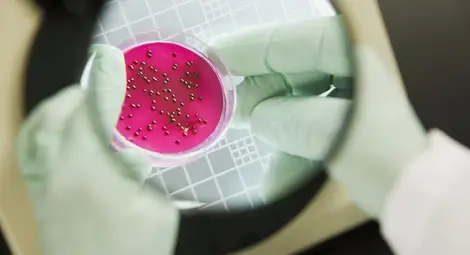 Руски учени разработват алтернативна на антибиотиците