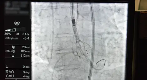 Забележително представяне на кардиолозите от Сърдечно-съдовия център на МЕДИКА на научен форум в Сърбия