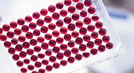 Услугите на Националната генетична лаборатория стават по-достъпни на пациентите извън София