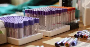 Нов случай на коклюш установен в Русе