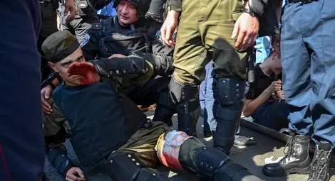 Един загинал и 90 ранени след протести в Киев заради закон за повече автономия на Изтока - обобщение Един загинал и 90 ранени след протести в Киев заради закон за повече автономия на Изтока - обобщение