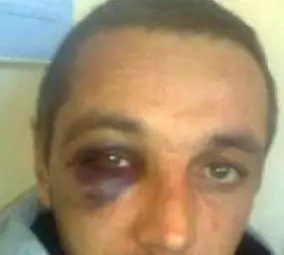 Предадоха на прокуратурата случая с бития арестант в Гоце Делчев 