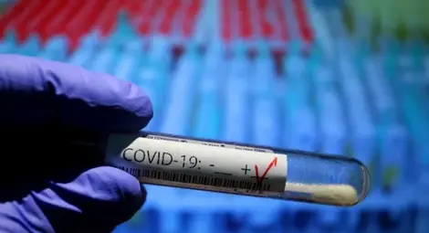 Откриха още 43-ма заразени с индийския вариант на COVID-19