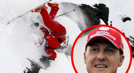 Обнадеждаващи признаци в състоянието на Шумахер