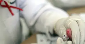 Безплатни тестове за СПИН на 15 август до Вазата