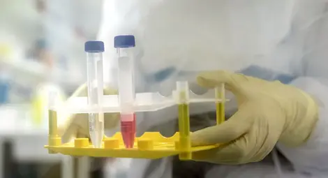 Дават по 1000 евро на човек за плазма за лечение на COVID-19 в Букурещ