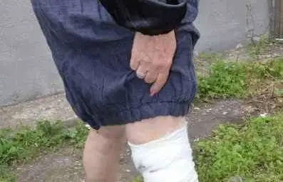 Агресивно куче нахапа жена и се озова светкавично в Приюта