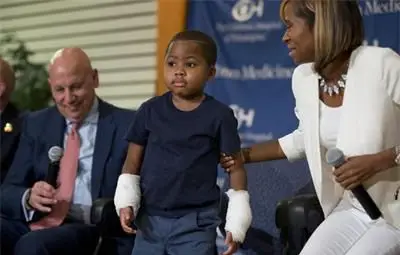 Присадиха две ръце на 8-годишно дете