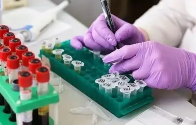 6 новозаразени с COVID-19 в Русенско 6 новозаразени с COVID-19 в Русенско