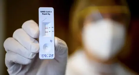 2485 новозаразени с коронавирус, 81 починали