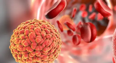 Ще лекуват рак на мозъка с вируса Зика Ще лекуват рак на мозъка с вируса Зика