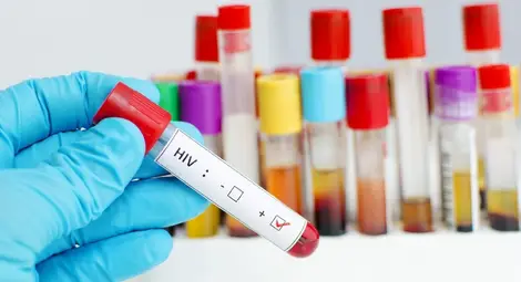 Два нови случая на СПИН открити в Русе