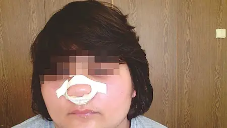 Осмокласник пребит от по-голямо момче в училище