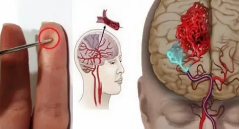 Иглата няма да спаси болния, но покрай използването й със сигурност ще се загуби безценно време. Иглата няма да спаси болния, но покрай използването й със сигурност ще се загуби безценно време.