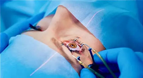 Да помогнем на Снежана отново да вижда света