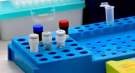 1336 нови случая, 11 починали