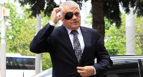 Валентин Радев сложи черна превръзка на окото в знак на солидарност