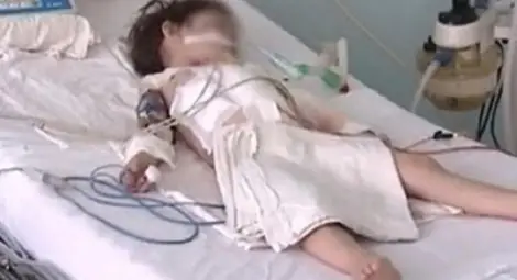 Лекари: Момиченцето е изпохапано от баща си, такова чудо не сме виждали!