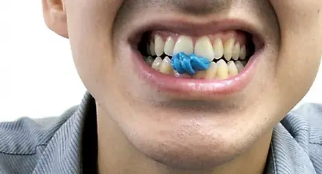 Дъвченето на дъвка може да предизвика мигрена