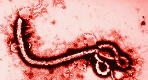 Шестима в болница в Испания заради ебола