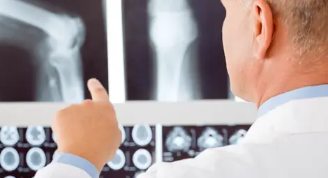 Мерят костна плътност само за 10 лева на 9 октомври