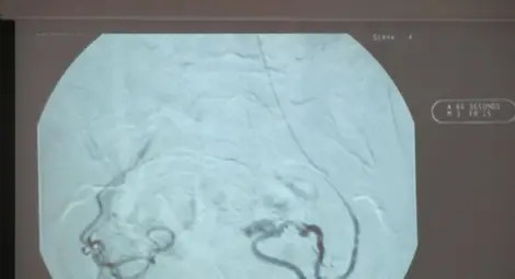 Д-р Кристиян Иванов: &bdquo;Медика&ldquo; може да обучава специалисти по емболизация