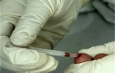 Двама със СПИН опитали да дарят кръв в Пловдив