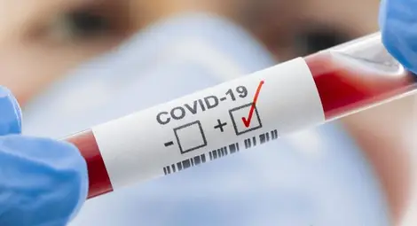 399 са потвърдените случаи на COVID-19 у нас