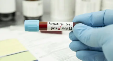 СЗО проверява случаите на мистериозен хепатит при децата в 12 страни