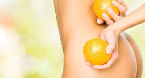  3 малко известни истини за целулита