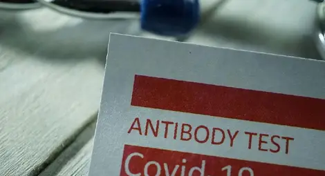 При влизане в Румъния ще може да пребиваваме с отрицателен PCR до 3 дни При влизане в Румъния ще може да пребиваваме с отрицателен PCR до 3 дни