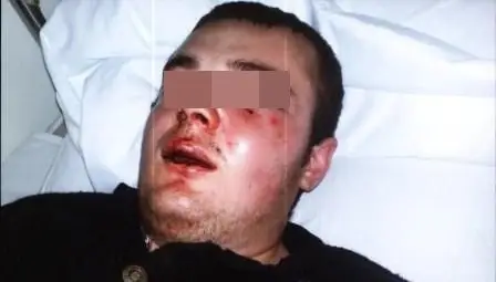 Йордан Симов: 3-ма с бухалки ме пребиха в таксито заради ресто за кокаин!