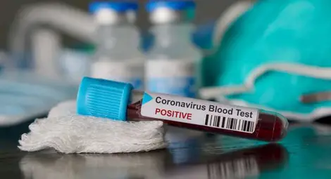 Здравното министерство даде пълната информация за ваксината на Pfizer/BioNTech