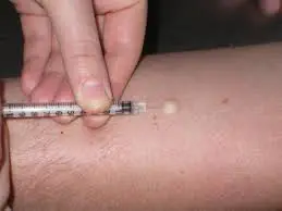 Световен ден за борба с туберкулозата 2025 г. с мото:  &bdquo;Да! Ние можем да спрем туберкулозата!&ldquo;  &bdquo;Ангажименти, инвестиции, резултати!&ldquo;  Кампания &bdquo;Седмица на отворените врати&ldquo; в Русе