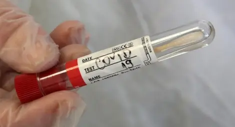 Оксфордският университет разработи 5-минутен тест за Covid-19