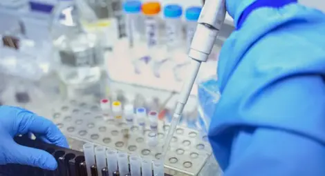 Как се изследват пробите за коронавирус в лабораториите?