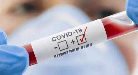 Лек ръст на заразените с COVID-19 у нас