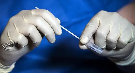 Четири пъти повече оздравели отколкото заразени с COVID-19 в Русенска област