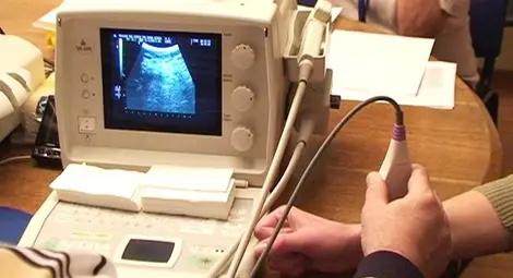 Днес е Световният ден за борба с остеопорозата