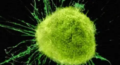 Откриха нов метод за борба с рака