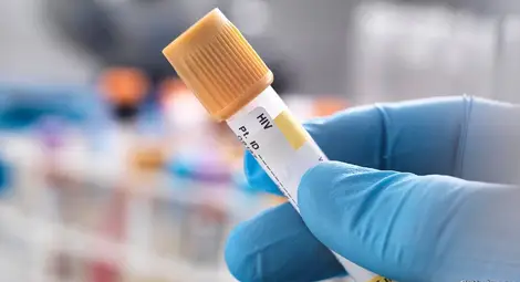 Два нови случая на СПИН в Русе